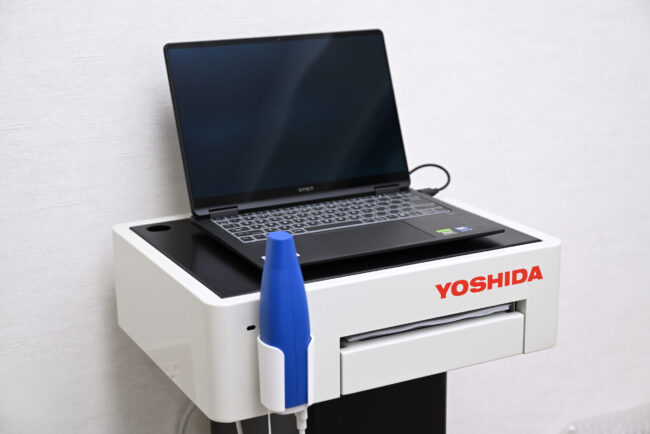 口腔内スキャナー